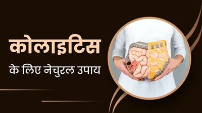 Colitis: कोलाइटिस (आंतों का रोग) होने पर अपनाएं ये 5 नेचुरल उपाय, दर्द और सूजन से मिलेगी राहत 