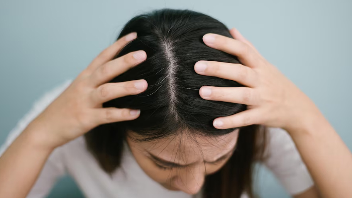 Dealing With A Sweaty Scalp? Here's What Causes It And Ways To Manage 