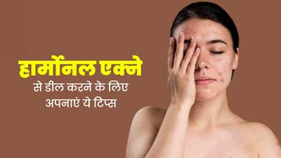 हार्मोनल एक्ने से डील करने के लिए अपनाएं ये 6 टिप्स, दूर होगी समस्या