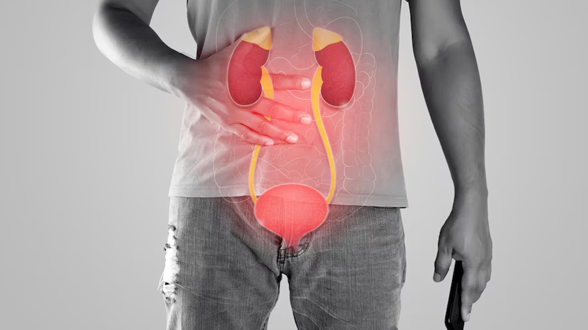 Can Exercises Improve An Overactive Bladder In Hindi