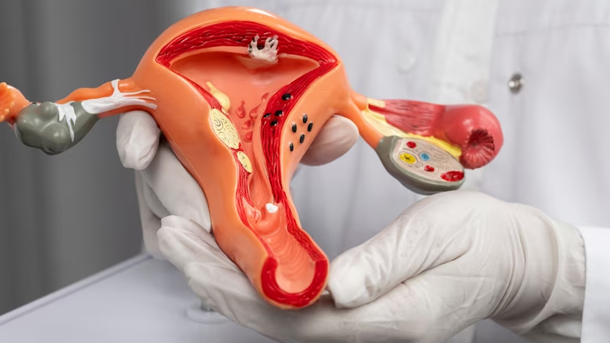 gynaecological-cancer