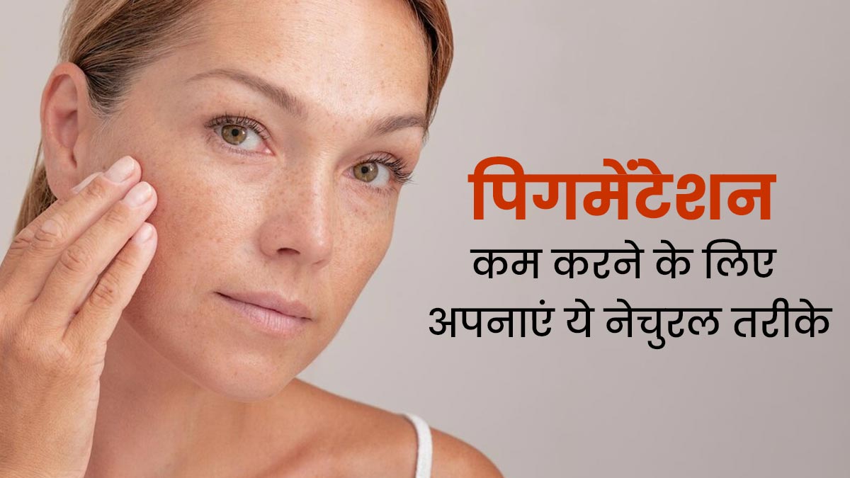 पिगमेंटेशन कम करने के लिए अपनाएं ये 3 नेचुरल तरीके, मिलेगा फायदा