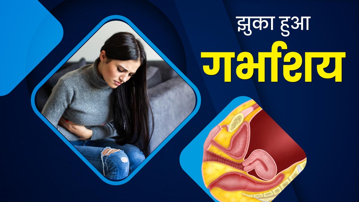 रेट्रोवर्टेड यूट्रस (झुका हुआ गर्भाशय) क्या है? एक्सपर्ट से जानें लक्षण और कारण