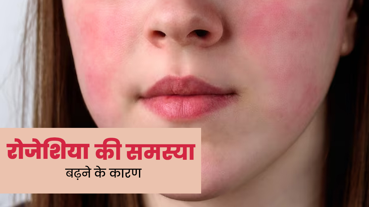 रोजेशिया (लाल चेहरा) की समस्या को बढ़ा सकती हैं ये 14 चीजें, जानें कैसे 