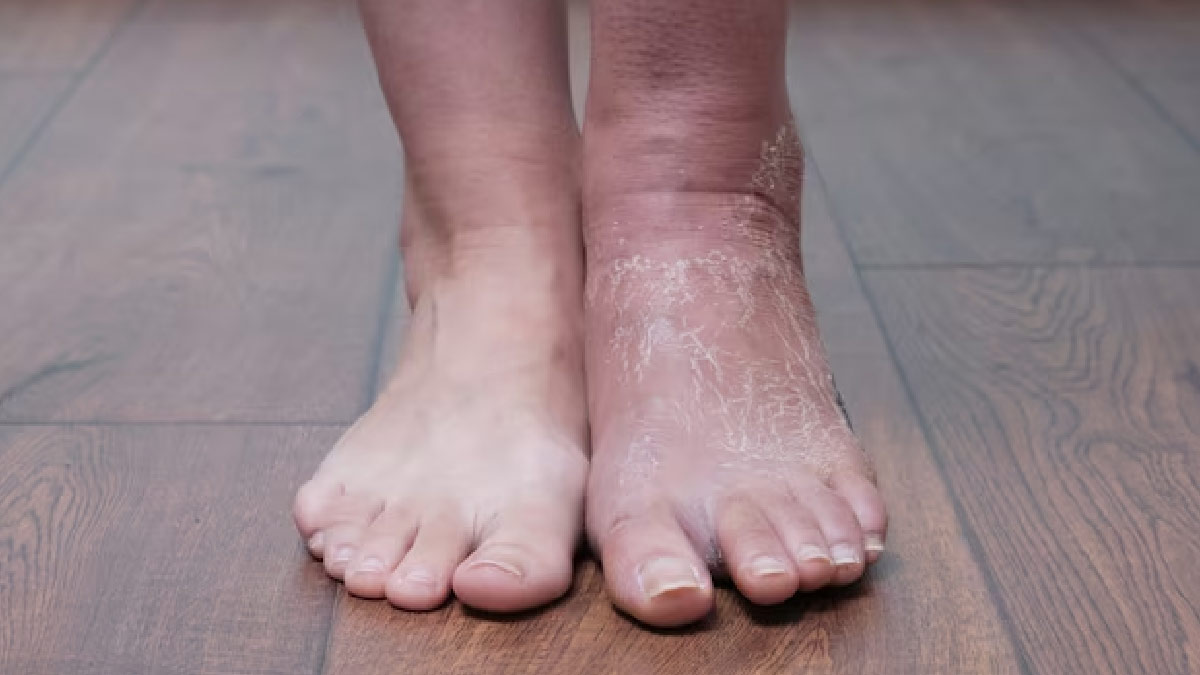 Prediabetes Symptoms In Feet In Hindi
