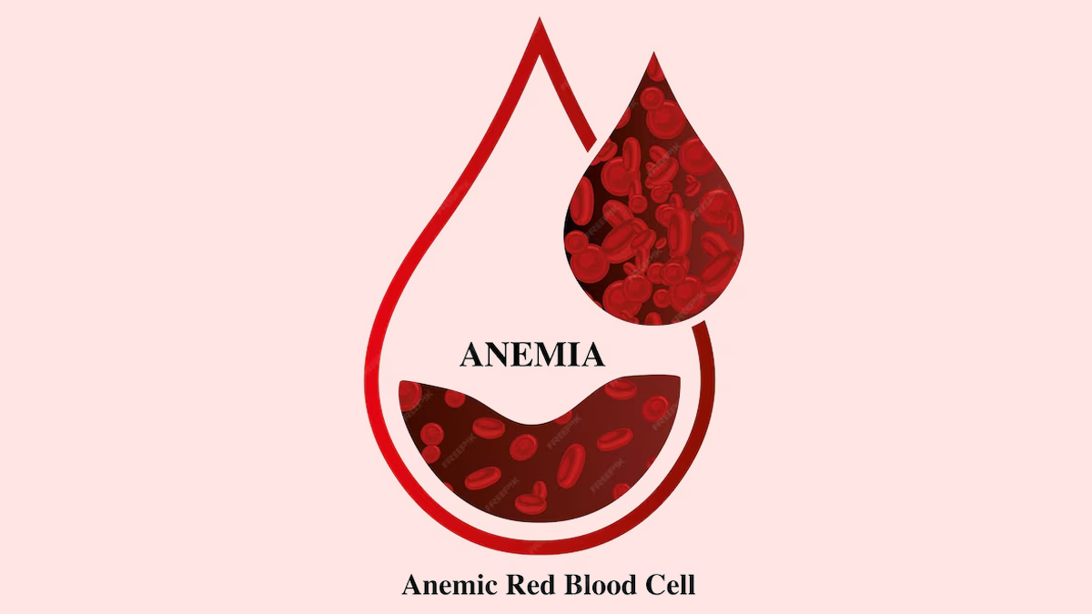anaemia