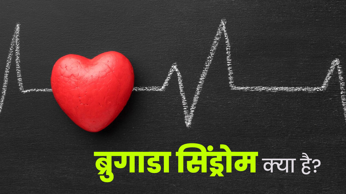 Brugada Syndrome: अन‍ियम‍ित हार्ट बीट का कारण हो सकता है ब्रुगाडा सिंड्रोम, डॉक्‍टर से जानें इसके बारे में