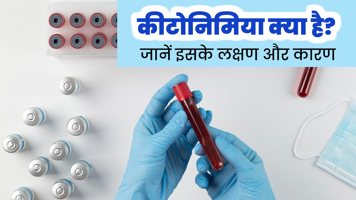 Ketonemia: कीटोनिमिया क्या है? जानें इसके लक्षण और कारण  