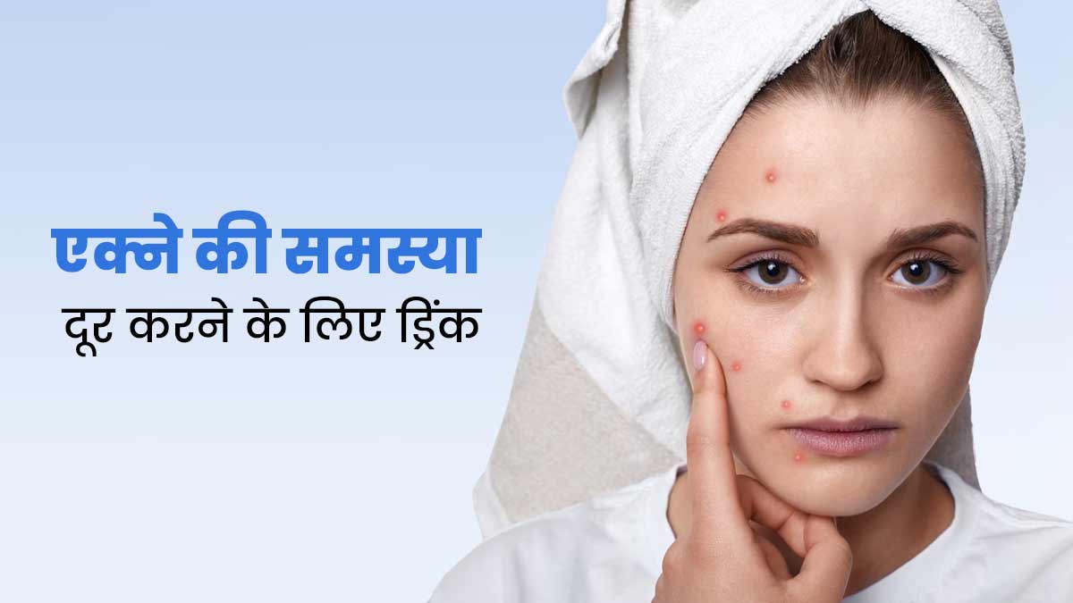 चेहरे पर कील-मुंहासों से हो गए हैं परेशान तो पिएं एक्सपर्ट की बताई ये ड्रिंक, दूर होगी समस्या