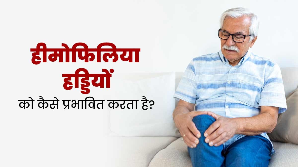 World Hemophilia Day 2024: हीमोफिलिया रोग हड्डियों को कैसे प्रभावित करता है? डॉक्‍टर से जानें