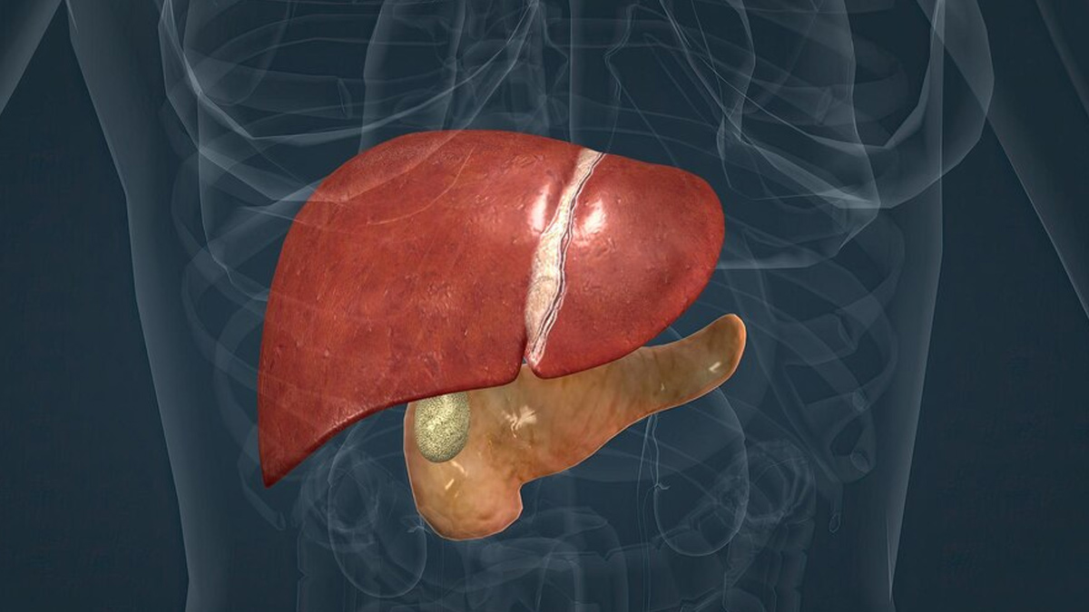 Fatty Liver Grades in Hindi