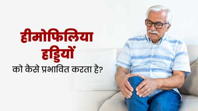 World Hemophilia Day 2024: हीमोफिलिया रोग हड्डियों को कैसे प्रभावित करता है? डॉक्‍टर से जानें