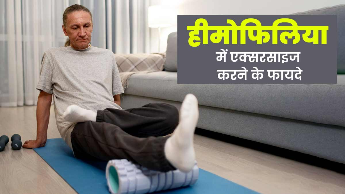 World Hemophilia Day 2024: हीमोफिलिया में फायदेमंद है एक्‍सरसाइज करना, एक्‍सपर्ट से जानें इसका सही तरीका 