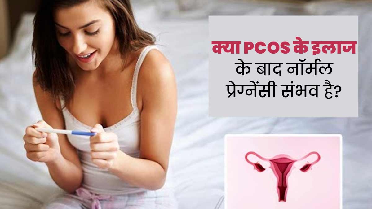 क्या पीसीओएस के इलाज के बाद नॉर्मल प्रेग्नेंसी संभव है? जानें डॉक्टर की राय