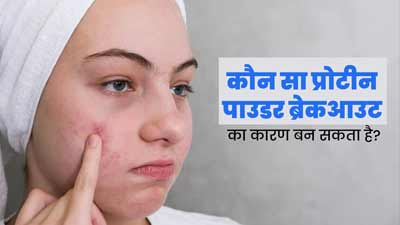 आपका प्रोटीन पाउडर भी हो सकता है मुंहासों का कारण, एक्सपर्ट से जानें किन प्रोटीन पाउडर से हो सकता है ब्रेकआउट