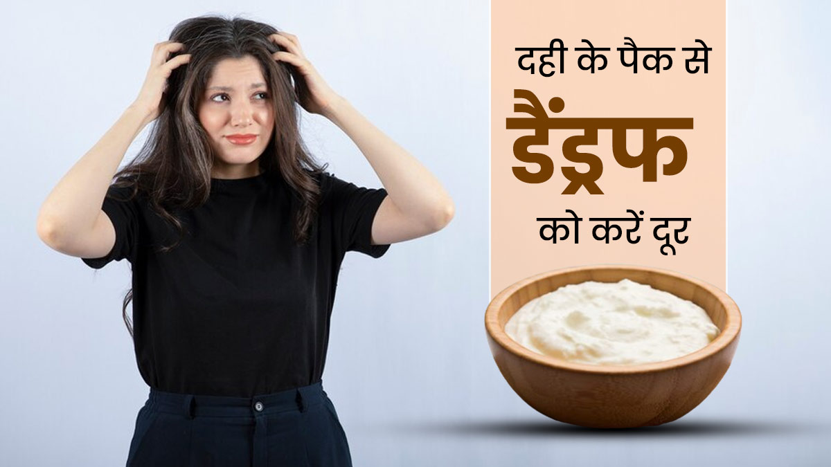 डैंड्रफ से छुटकारा पाने के लिए दही में एक साथ मिलाकर लगाएं ये 4 चीजें, खुजली और इरिटेशन से भी मिलेगा निजात