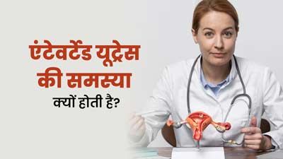 एंटेवर्टेड यूट्रस (आगे की ओर झुका गर्भाशय) की समस्या क्यों होती है? जानें इसके लक्षण और कारण  