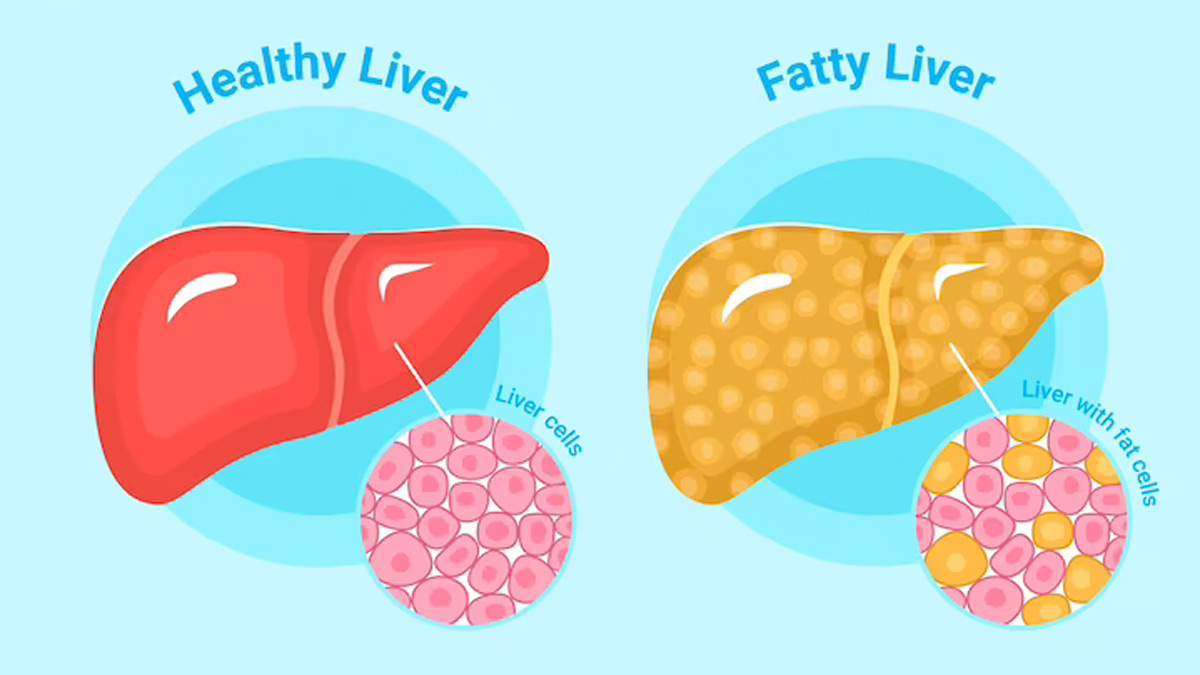 Date Theme History Significance of World Liver Day
