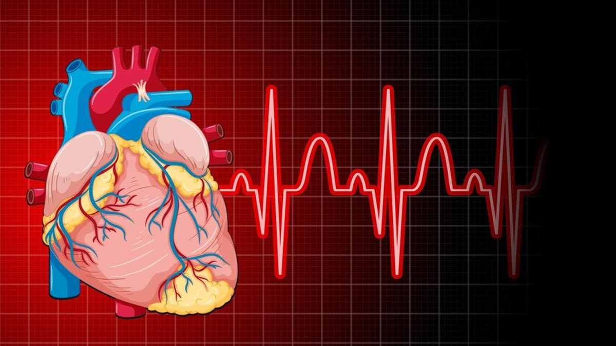 Problem With Heart Rate? Expert Explains Arrhythmia, Its Causes, And ...