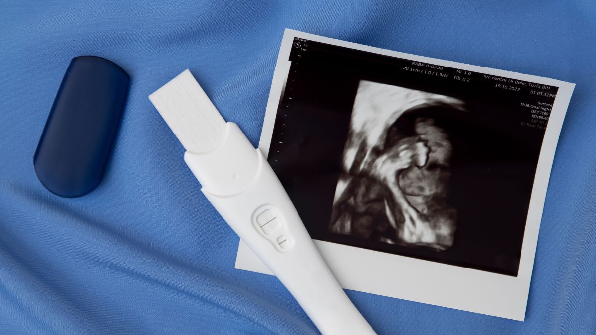 Offering Hope To Aspiring Mothers, 33-Year-Old Trumps Morbid Obesity, Hypothyroidism In High-Risk Pregnancy