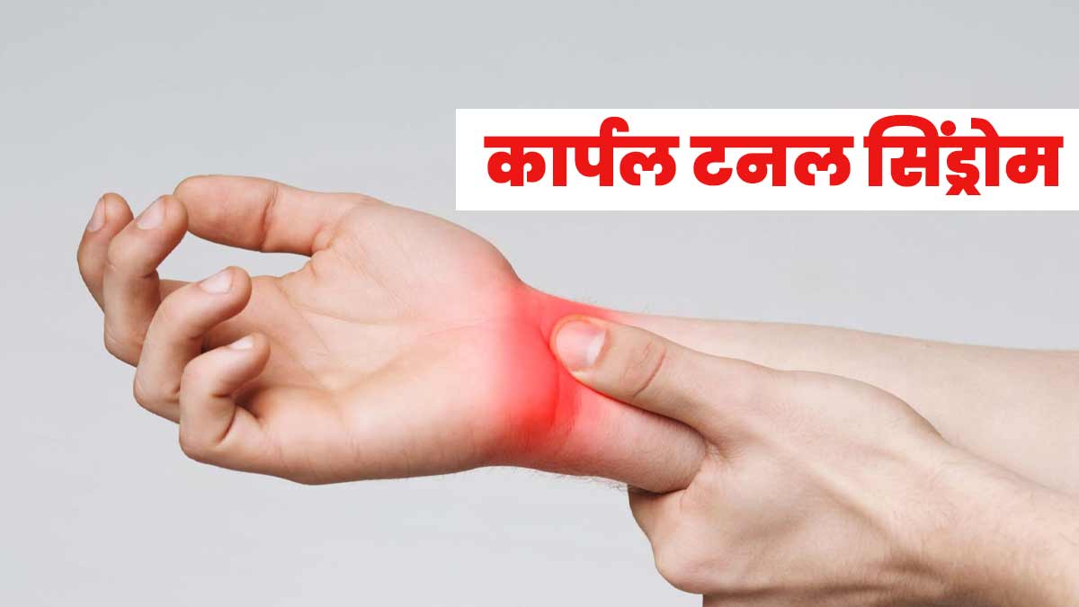 कार्पल टनल सिंड्रोम की वजह से हो सकती है हाथों में झुनझुनाहट, जानें क्या हैं इसके जोखिम कारक 