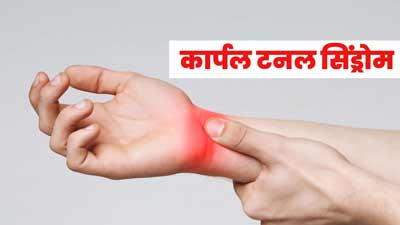 कार्पल टनल सिंड्रोम की वजह से हो सकती है हाथों में झुनझुनाहट, जानें क्या हैं इसके जोखिम कारक 