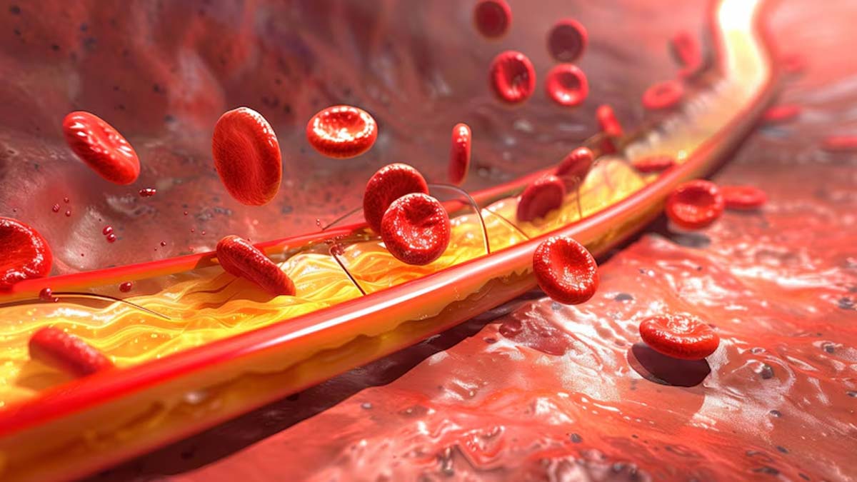 Want To Clean Your Arteries? Here Are Some Food To Eat