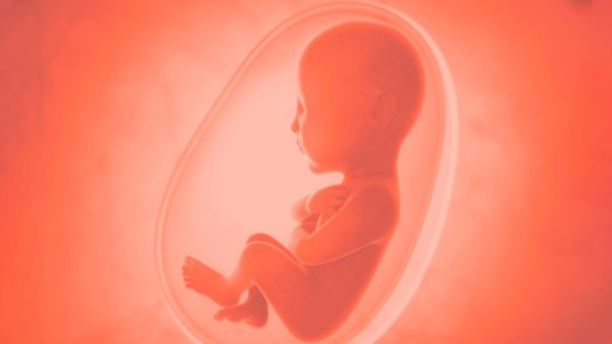 Abortion