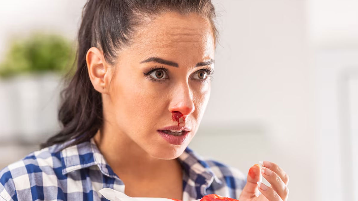 Nosebleeding For No Reason? Expert Lists Some Of The Possible Causes