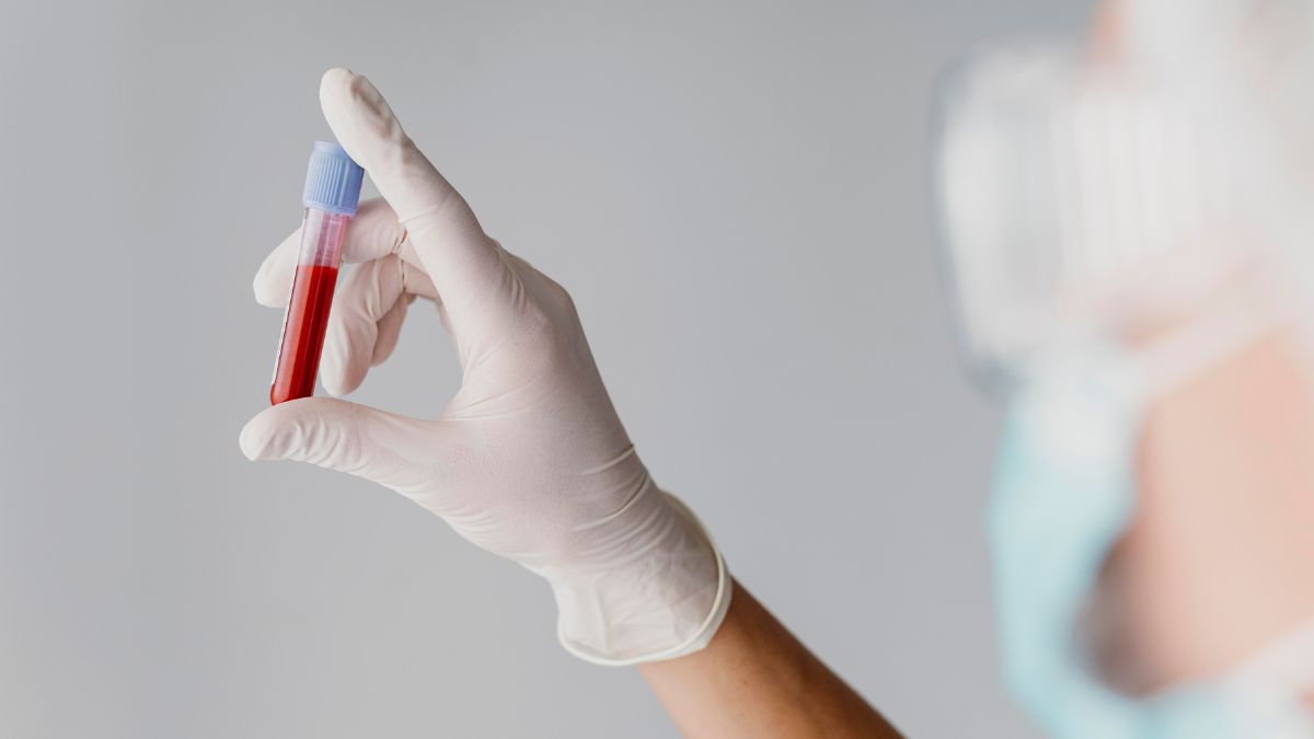 Belgian Man With Auto-Brewery Syndrome Acquitted Of Drunk Driving: How To Diagnose, Treat This Condition
