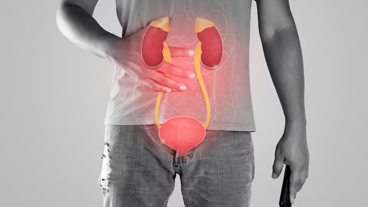 Kidney Disease Causes Prevention and Management Tips