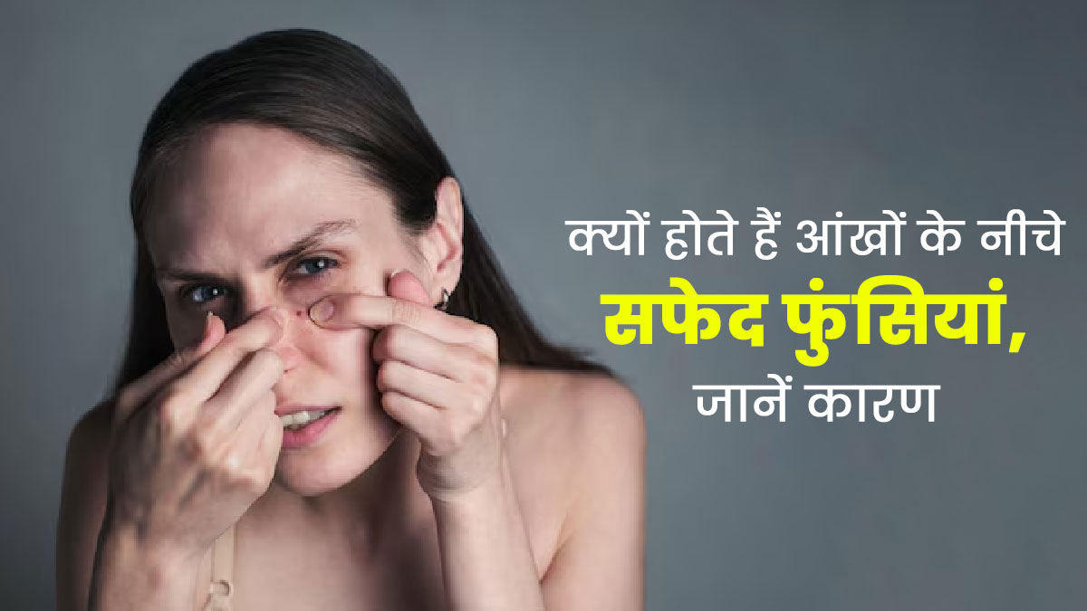 डेड स्किन सेल्स की वजह से आंखों के नीचे हो सकती हैं सफेद फुंसियां (Milia), जानें इसके कारण और लक्षण