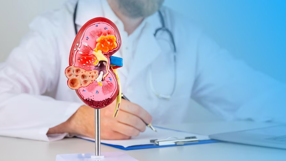 Rising Problem of Kidney Disease: Prevention and Management Tips