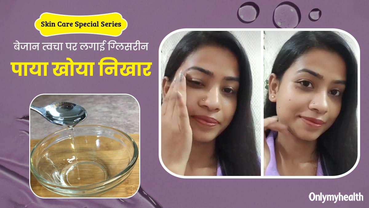 बेजान त्‍वचा को र‍िपेयर करने के ल‍िए मंजू ने आजमाया ग्‍ल‍िसरीन हैक, फ‍िर से पाया खोया न‍िखार 