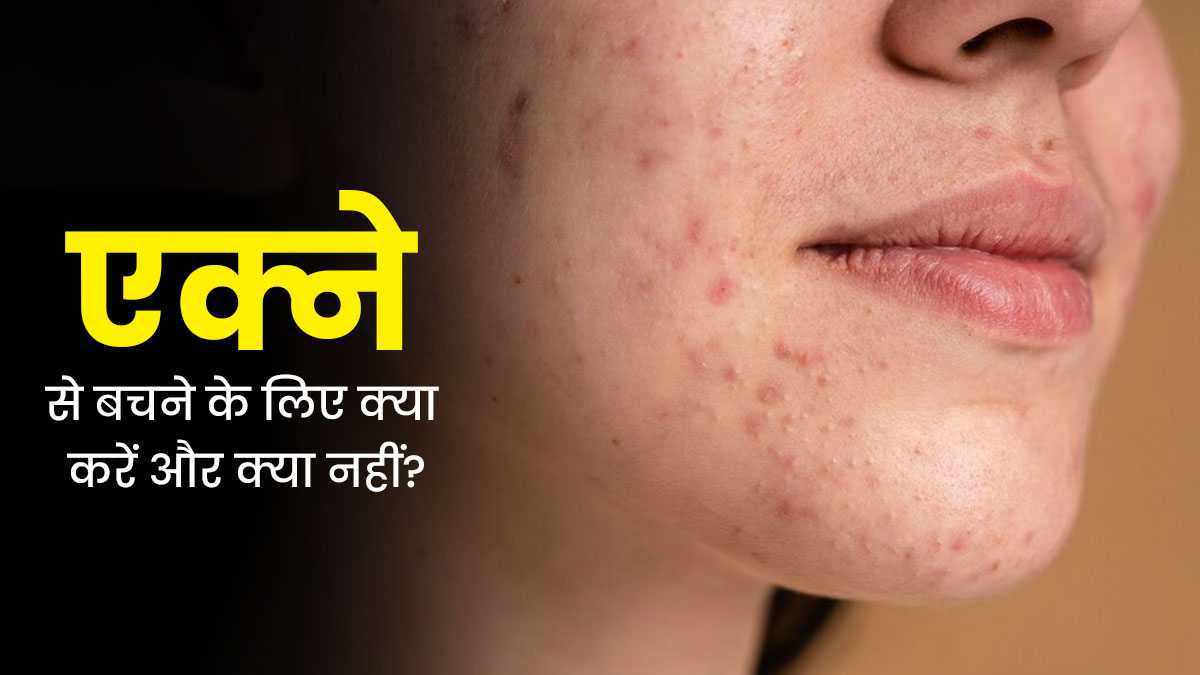 चेहरे पर मुंहासों का कारण कहीं मेकअप की गलतियां तो नहीं? जानें क्या करें और क्या नहीं