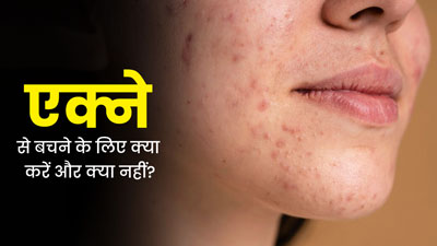 चेहरे पर मुंहासों का कारण कहीं मेकअप की गलतियां तो नहीं? जानें क्या करें और क्या नहीं