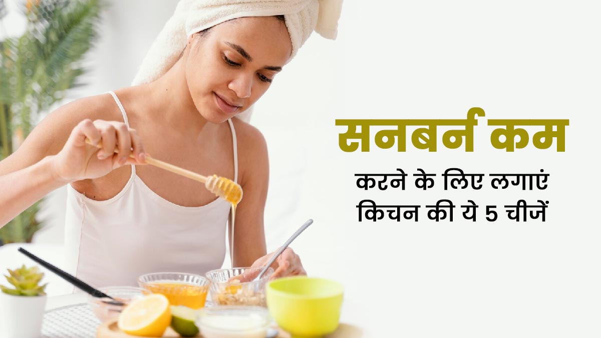 सनबर्न होने पर लगाएं किचन में मौजूद ये 5 चीजें, टैनिंग से मिलेगा छुटकारा