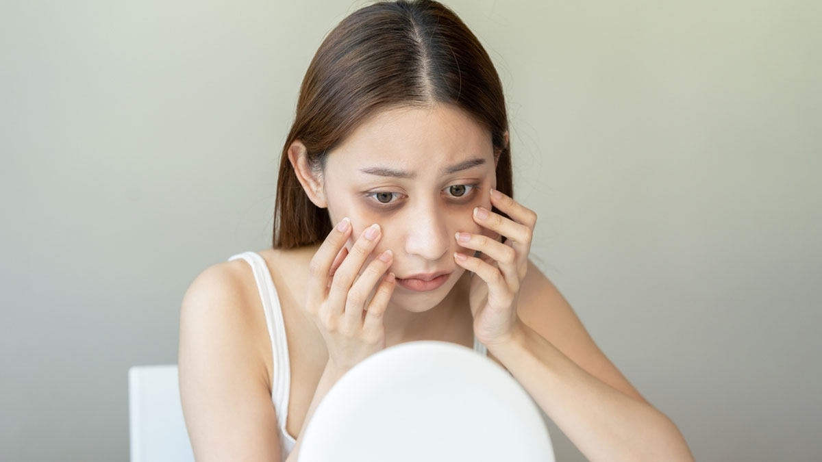 What Causes Droopy Eyelids? Know Its Treatment | OnlyMyHealth