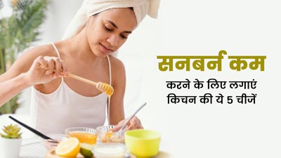 सनबर्न होने पर लगाएं किचन में मौजूद ये 5 चीजें, टैनिंग से मिलेगा छुटकारा
