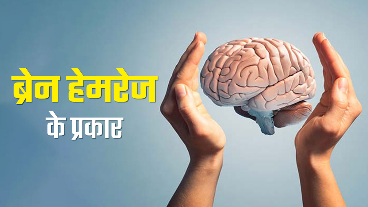 Brain Hemorrhage: ब्रेन हेमरेज कितने प्रकार के होते हैं? एक्सपर्ट से जानें 