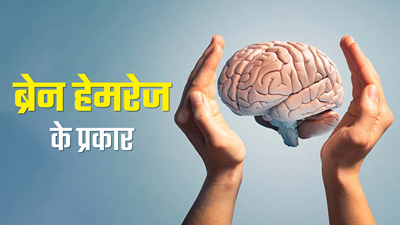 Brain Hemorrhage: ब्रेन हेमरेज कितने प्रकार के होते हैं? एक्सपर्ट से जानें 