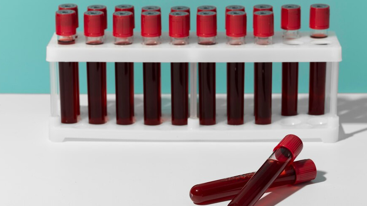 Hemoglobin Normal Range By Age