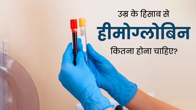 उम्र के हिसाब से हीमोग्लोबिन कितना होना चाहिए? जानें डॉक्टर से