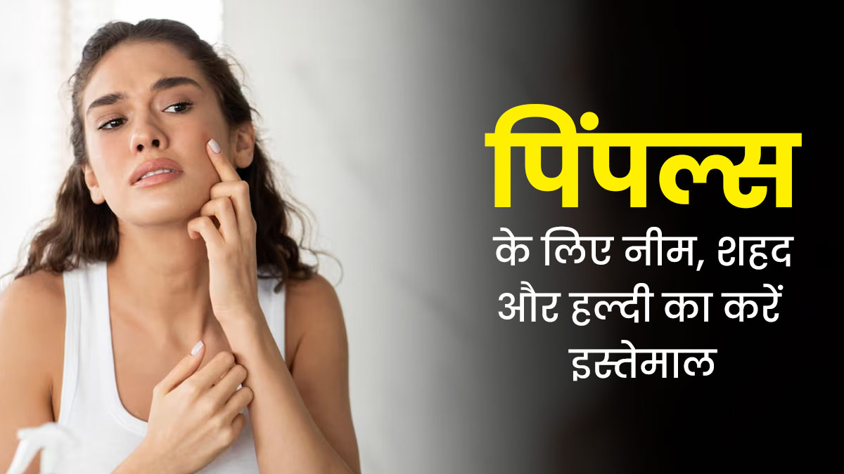 गर्मियों में पिंपल्स से छुटकारा पाने के लिए लगाएं नीम, शहद और हल्दी का पेस्ट, जानें तरीके और फायदे