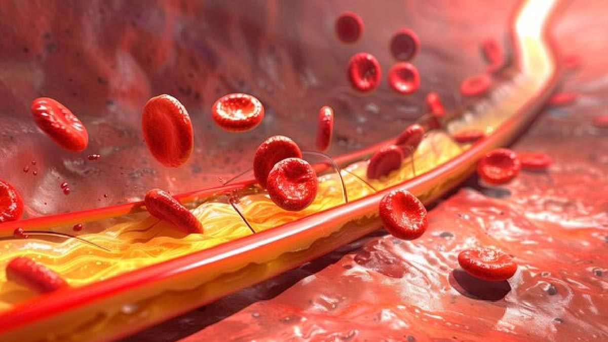 how to control cholesterol