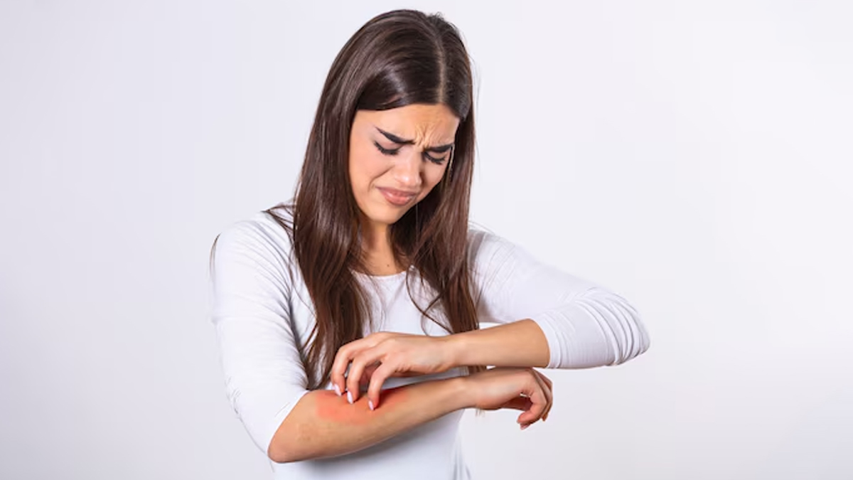itching treatment in hindi