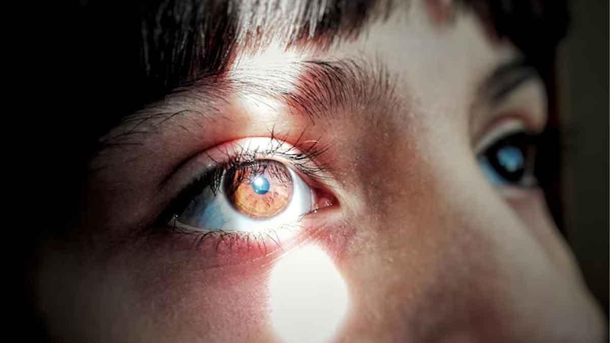 What Are The Most Prevalent Eye Disorders In India? Doctor Lists Four Eye Diseases