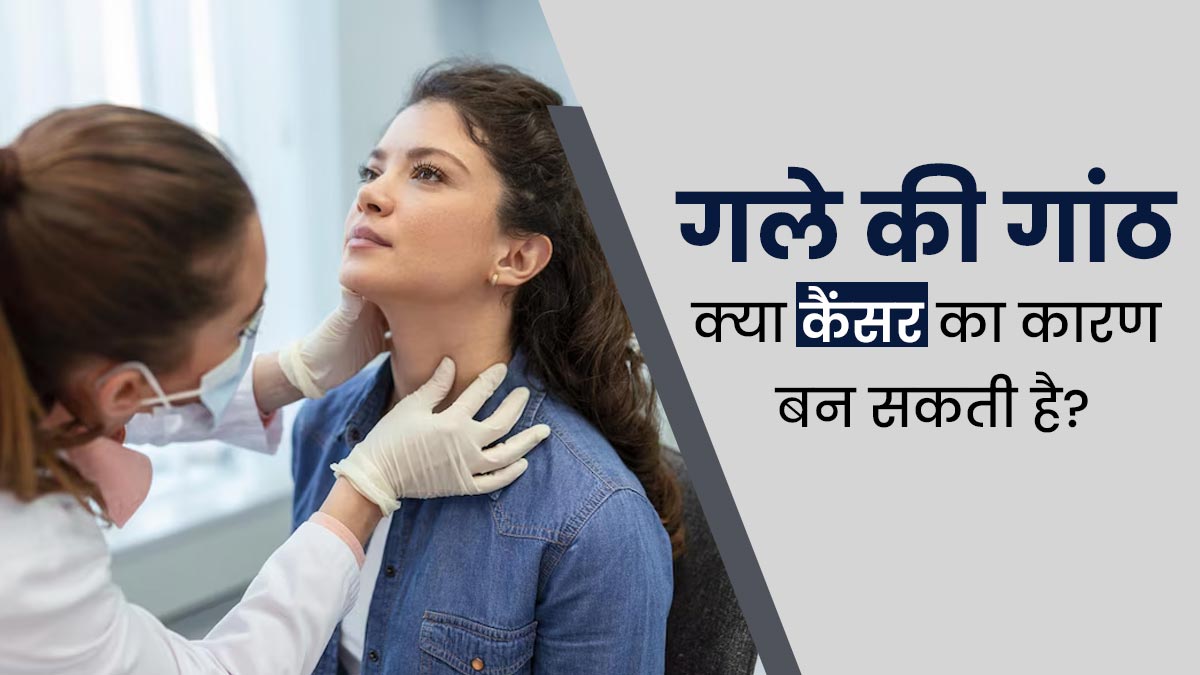  क्या गले की गांठ कैंसर का कारण हो सकती है? डॉक्टर से जानें 