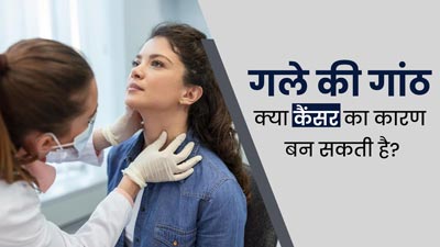  क्या गले की गांठ कैंसर का कारण हो सकती है? डॉक्टर से जानें 