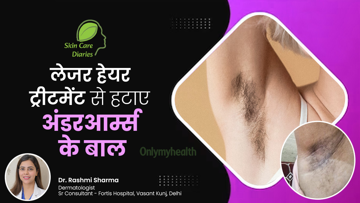 अंडरआर्म्स के बाल कम करने के लिए दीपा दुबे ने लिया लेजर ट्रीटमेंट, जानें कितना कारगर होता है यह ऑप्शन?